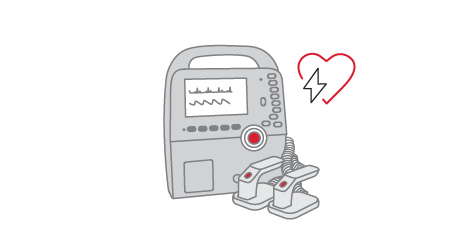 manual defibrillator